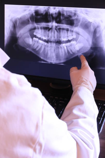 Best Emergency Dental Care for Broken or Chipped Teeth in Rolling Hills, CA